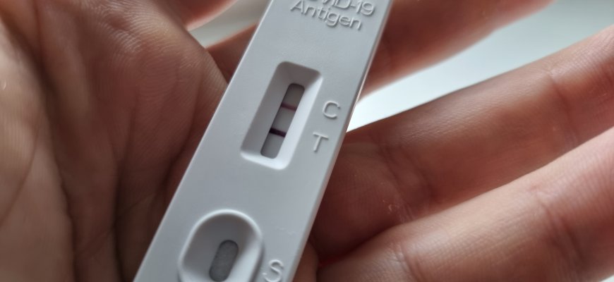 Gąsdina be reikalo: Rokiškyje rudeninių ligų rodikliai į aukštumas dar nekopia