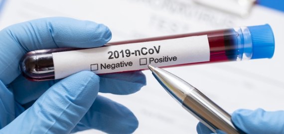 Patvirtintų sergančiųjų koronavirusu skaičius Lietuvoje pasiekė 187