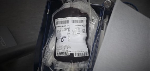 Gydymo įstaigoms kritiškai trūksta kraujo, skubiai prašoma visuomenės pagalbos