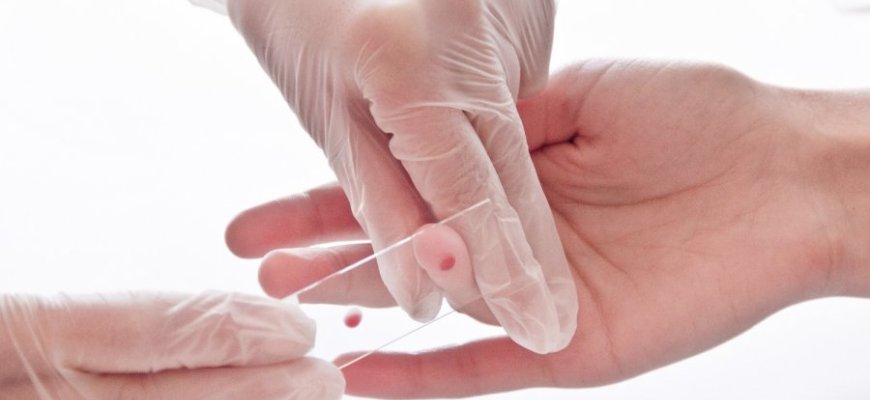 Specialistai primena apie virusinių hepatitų tyrimų svarbą