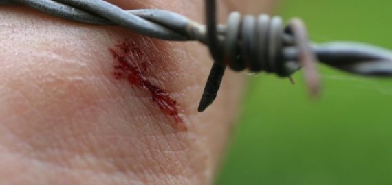 Kaip išvengti sunkios ligos - stabligės?