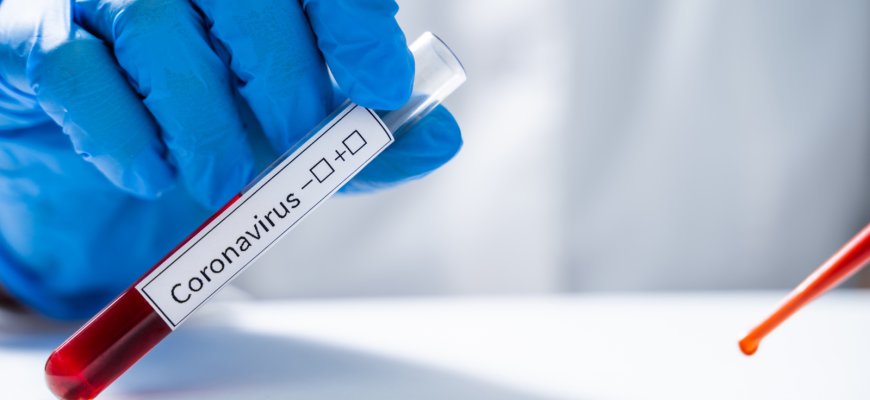 Per parą Lietuvoje patvirtinti septyni nauji koronaviruso atvejai