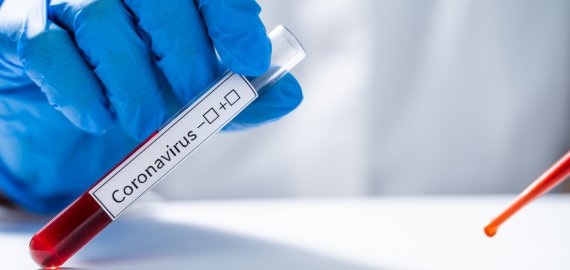 Per parą patvirtinti 44 nauji koronaviruso atvejai