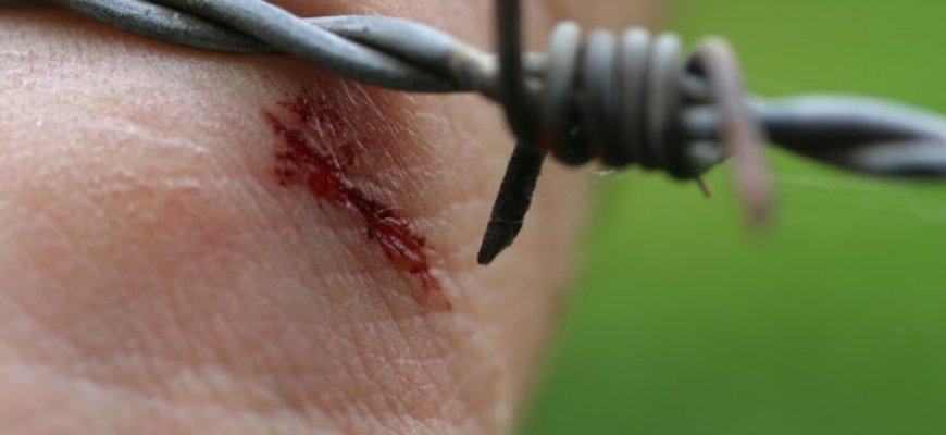 Kaip išvengti sunkios ligos - stabligės?