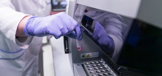 Už koronaviruso gydymą nereikės mokėti ir neturintiesiems privalomojo sveikatos draudimo