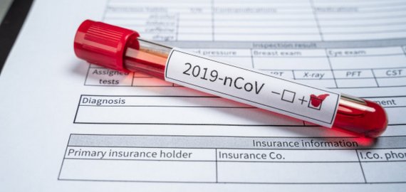 Lietuvoje nustatyti dar du koronaviruso atvejai, bendras skaičius – 36