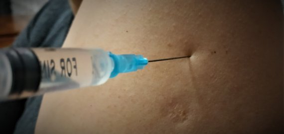 Iš naujos ekspertų grupės lūpų – kritika galimybių pasui ir skiepams: ragina sekti Norvegijos pavyzdžiu